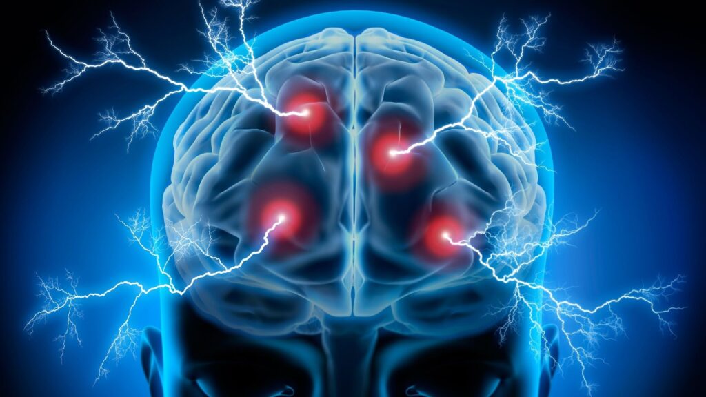 Ein leuchtend blaues 3D-Modell eines menschlichen Gehirns wird von elektrischen Blitzen getroffen. Rote, glühende Knotenpunkte visualisieren den permanenten neuronalen Dauer-Alarm, der eine professionelle Burnout Prävention für Führungskräfte zwingend erforderlich macht.